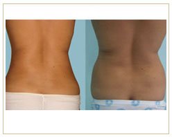 Slider image (6) Roura DermSurgery